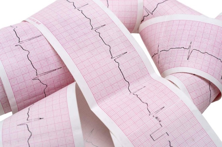 Papel milimetrado para electrocardiograma